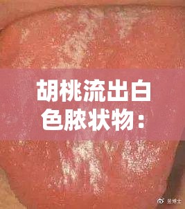 胡桃流出白色脓状物：探究其背后的原因及影响